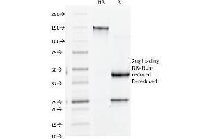 SDS-PAGE Analysis Purified CD61 Monoclonal Antibody (Y2/51). (Integrin beta 3 Antikörper)