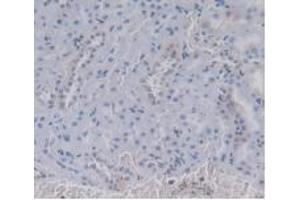 IHC-P analysis of Rat Kidney Tissue, with DAB staining. (Prothrombin Antikörper  (AA 201-323))