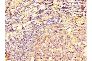IHC image of ABIN7149787 diluted at 1:500 and staining in paraffin-embedded human tonsil tissue performed on a Leica BondTM system. (Desmoglein 3 Antikörper  (AA 70-615))