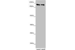 Western blot All lanes: DDX11 antibody at 8. (DDX11 Antikörper  (AA 1-220))
