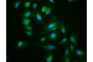 Immunofluorescence staining of Hela cells with ABIN7157599 at 1:200, counter-stained with DAPI.