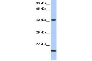 WB Suggested Anti-SEC14L4 Antibody Titration: 0. (SEC14L4 Antikörper  (N-Term))