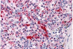 Human Spleen: Formalin-Fixed, Paraffin-Embedded (FFPE) (TLN1 Antikörper  (AA 1052-1150))