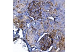IHC analysis of CD34 using anti-CD34 antibody (ABIN7600282).