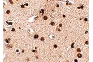 Immunohistochemistry (IHC) image for anti-Regulating Synaptic Membrane Exocytosis 3 (RIMS3) (N-Term) antibody (ABIN1031542) (RIMS3 Antikörper  (N-Term))