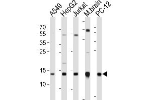 Western blot analysis of lysates from A549, HepG2, Jurkat cell line, mouse brain tissue lysate, rat PC-12 cell line (from left to right), using ATP5D Antibody (C-term) (ABIN6242954 and ABIN6577658). (ATP5F1D Antikörper  (C-Term))