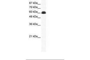 Image no. 1 for anti-DEAD (Asp-Glu-Ala-Asp) Box Polypeptide 27 (DDX27) (AA 118-167) antibody (ABIN202920) (DDX27 Antikörper  (AA 118-167))