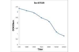 Antigen: 2 µg/100 µL  Primary: Antiserum, 1:500, 1:1000, 1:2000, 1:4000, 1:8000, 1:16000, 1:32000;  Secondary: HRP conjugated Rabbit Anti-Goat IgG at 1: 5000;  TMB staining Read the data in Microplate Reader by 450nm. (CD19 Antikörper  (AA 151-250))