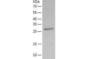 Western Blotting (WB) image for Synaptotagmin V (SYT5) (AA 109-386) protein (His tag) (ABIN7284253) (Synaptotagmin V Protein (SYT5) (AA 109-386) (His tag))