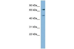 WB Suggested Anti-GFPT2  Antibody Titration: 0. (GFPT2 Antikörper  (Middle Region))