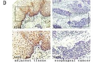 The expression and methylation status of IGFBPL1 in human esophageal dysplasia and ESCC. (IGFBPL1 Antikörper  (AA 201-278))