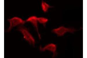 ABIN6276050 staining HuvEc by IF/ICC. (PAQR5 Antikörper  (C-Term))