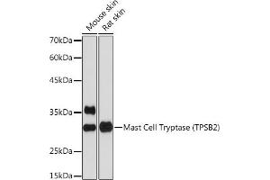 Western blot analysis of extracts of various cell lines, using Mast Cell Tryptase (TPSB2) (TPSB2) Rabbit mAb (ABIN7271017) at 1:1000 dilution. (TPSB2 Antikörper)