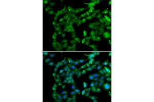 Immunofluorescence analysis of U2OS cells using PRKAB2 antibody (ABIN6291758).