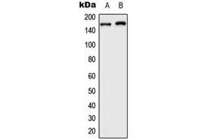 Western blot analysis of BAF250B expression in HeLa (A), HepG2 (B) whole cell lysates.