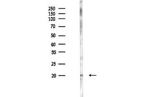 anti-Apoptosis-Inducing, TAF9-Like Domain 1 (APITD1) (C-Term) antibody