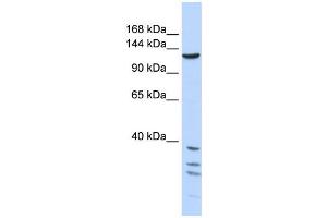 Western Blotting (WB) image for anti-Tankyrase, TRF1-Interacting Ankyrin-Related ADP-Ribose Polymerase (TNKS) antibody (ABIN2458045) (TNKS Antikörper)