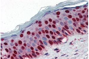 Human Skin (formalin-fixed, paraffin-embedded) stained with NPM1 antibody ABIN364324 at 5 ug/ml followed by biotinylated anti-mouse IgG secondary antibody ABIN481714, alkaline phosphatase-streptavidin and chromogen. (NPM1 Antikörper  (AA 81-294))