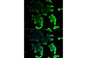 Immunofluorescence analysis of HeLa cells using TANK antibody (ABIN5974093). (TANK Antikörper)