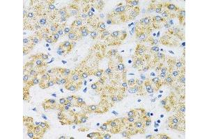 Immunohistochemistry of paraffin-embedded Human liver using SLC16A4 Polyclonal Antibody at dilution of 1:100 (40x lens). (SLC16A4 Antikörper)