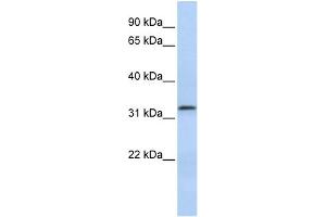 WB Suggested Anti-LACTB2 Antibody Titration: 0. (LACTB2 Antikörper  (Middle Region))