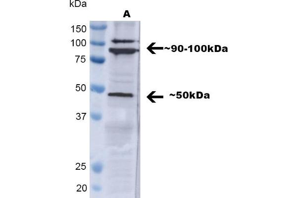 TNFRSF1A Antikörper  (AA 20-43) (HRP)