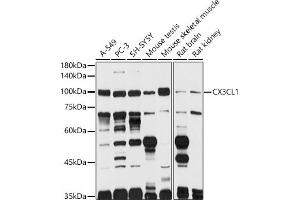 Western blot analysis of extracts of various cell lines, using CX3CL1 antibody (ABIN6129035, ABIN6139265, ABIN6139266 and ABIN6218481) at 1:1000 dilution. (CX3CL1 Antikörper  (AA 365-397))