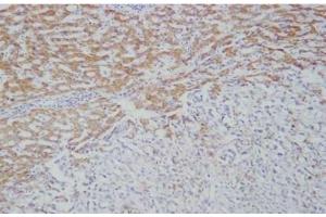 IHC: Immunohistochemical analysis of Ficolin-2 in frozen human liver tissue using mAb GN5 (Ficolin 2 Antikörper)