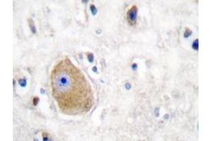 Immunohistochemistry analyzes of HADH2 antibody in paraffin-embedded human brain tissue. (HSD17B10 Antikörper)