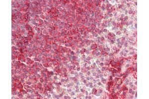 Immunohistochemistry (IHC) image for anti-Integrin alpha-L (ITGAL) (AA 722-751) antibody (ABIN1909677)