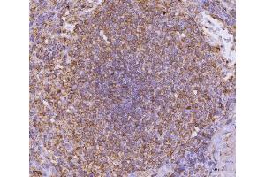 IHC analysis of CD135/FLT3 using anti-CD135/FLT3 antibody (ABIN7602257).