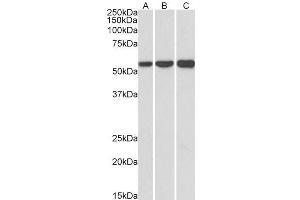 ABIN5539671 (1µg/ml) staining of HeLa (A), HepG2 (B) and K562 (C) lysates (35µg protein in RIPA buffer).