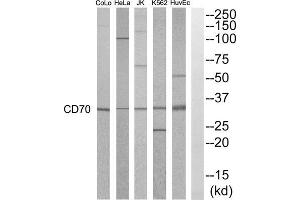 Western blot analysis of extracts from HuvEC, K562, HepG2, Jurkat, HeLa and COLO205 cells, using CD70 antibody. (CD70 Antikörper  (Internal Region))