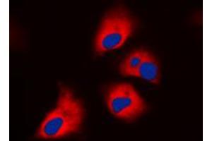 Immunofluorescent analysis of S6K1 (pT444) staining in HepG2 cells. (RPS6KB1 Antikörper  (C-Term, pSer444))