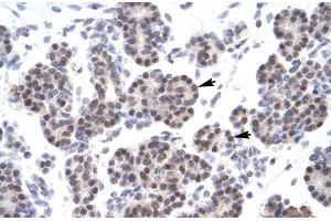 Immunohistochemistry (IHC) image for anti-X-Ray Repair Complementing Defective Repair in Chinese Hamster Cells 5 (Double-Strand-Break Rejoining) (XRCC5) (C-Term) antibody (ABIN2778271)