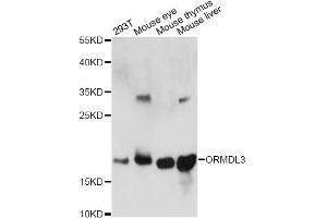 Western blot analysis of extracts of various cell lines, using ORMDL3 antibody.