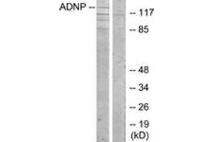Western Blotting (WB) image for anti-Activity-Dependent Neuroprotector Homeobox (ADNP) (AA 111-160) antibody (ABIN2889758) (ADNP Antikörper  (AA 111-160))