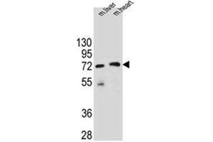 Western blot analysis of KCTD8 Antibody (C-term) in mouse liver and heart tissue lysates (35ug/lane).