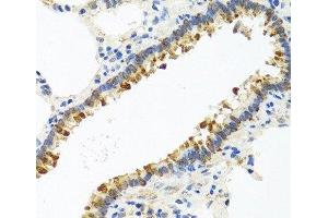 Immunohistochemistry of paraffin-embedded Rat lung using CST4 Polyclonal Antibody at dilution of 1:100 (40x lens). (CST4 Antikörper)