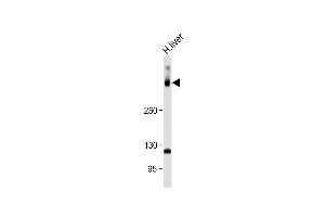 Anti-SYNE2 Antibody (N-Term) at 1:1000 dilution + Human liver lysate Lysates/proteins at 20 μg per lane. (SYNE2 Antikörper  (AA 1843-1877))