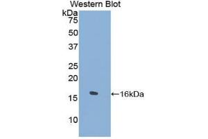 Western blot analysis of the recombinant protein. (TPSD1 Antikörper  (AA 99-191))