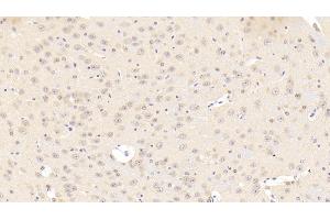 Detection of CACNa1C in Mouse Cerebrum Tissue using Polyclonal Antibody to Calcium Channel, Voltage Dependent, L-Type, Alpha 1C Subunit (CACNa1C) (CACNA1C Antikörper  (AA 1978-2139))