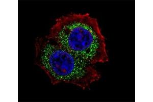 Fluorescent confocal image of MCF-7 cell stained with Estrogen Receptor antibody at 1:25. (Estrogen Receptor alpha Antikörper  (Isoform 4))