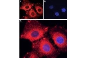 Expression of ASIC1 in rat C6 glioma cells - Immunocytochemical staining of fixed and permeabilized C6 glioma cells. (ASIC1 Antikörper  (C-Term, Intracellular))