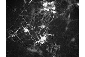 Immunochemical staining of cultured mouse caudate neurons with Ppp1r1b polyclonal antibody . (DARPP32 Antikörper  (N-Term))