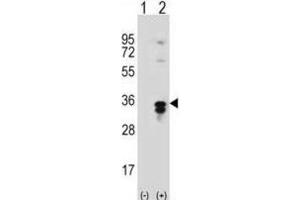 Western Blotting (WB) image for anti-Palmitoyl-Protein Thioesterase 1 (PPT1) antibody (ABIN3001553) (PPT1 Antikörper)