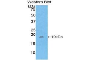 Western Blotting (WB) image for anti-Pleckstrin Homology-Like Domain, Family A, Member 2 (PHLDA2) (AA 9-140) antibody (ABIN1860206)