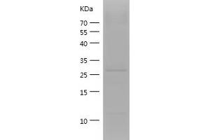 Western Blotting (WB) image for Apolipoprotein A-I (APOA1) (AA 25-267) protein (His-IF2DI Tag) (ABIN7121863)