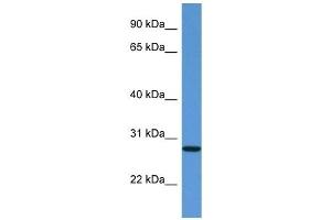 Western Blot showing EDN3 antibody used at a concentration of 1 ug/ml against Fetal Kidney Lysate (Endothelin 3 Antikörper  (C-Term))