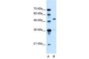 Image no. 2 for anti-Solute Carrier Family 37 (Glycerol-3-Phosphate Transporter), Member 3 (SLC37A3) (AA 224-273) antibody (ABIN6736664) (SLC37A3 Antikörper  (AA 224-273))